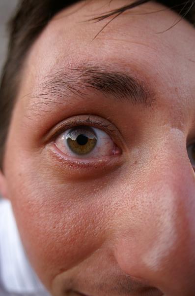 PICT2378.JPG - Phil's eye